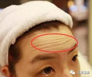 第一章：额头发旋与面相格局的深度关联