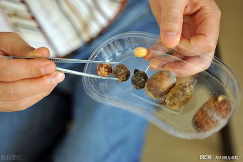 生肖虎：作息不规律与熬夜的危害