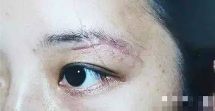 眉毛浓密与面相学之理论框架
