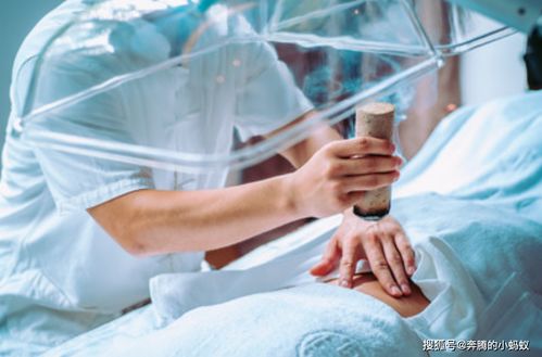 艾灸热敷对治疗痛风引起的水肿有效吗？