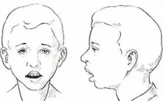 如何调整八字多水少金，以减少疾病和灾难的发生？