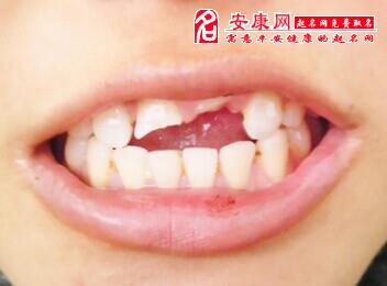 三、  风水学视角下的“月牙”效应
