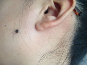 鉴别诊断与治疗原则：理性审视与科学干预