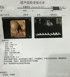 一、先来点轻巧松话题：为哪些你会想了解当前这个问题？