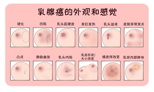 4. 绝经年龄晚：