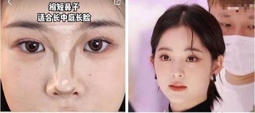 一、 光亮且肉感充盈的饱满鼻头（俗称“老蚕式”）