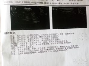 2. 子宫附件炎症及妇科病症：身体里的较小麻烦