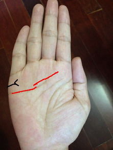 特殊纹路与异常征兆的风险评估